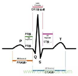 ĵͼе P-QRS-T